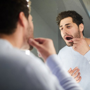 San Jose patient using ice pack on cheek 