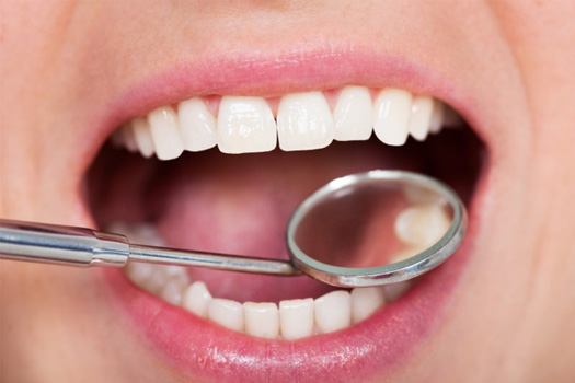 Close up of dental mirror examining a patient’s teeth