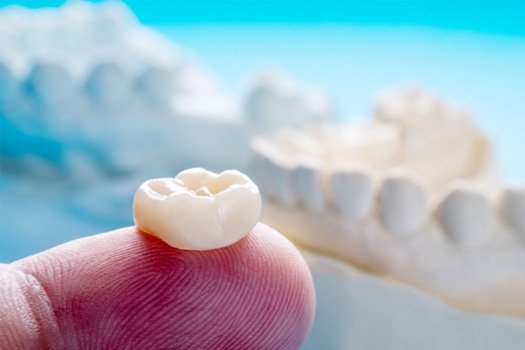 Tooth-colored crown resting on a dentist’s fingertip