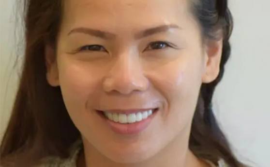 After photo of perfectly straight, white teeth