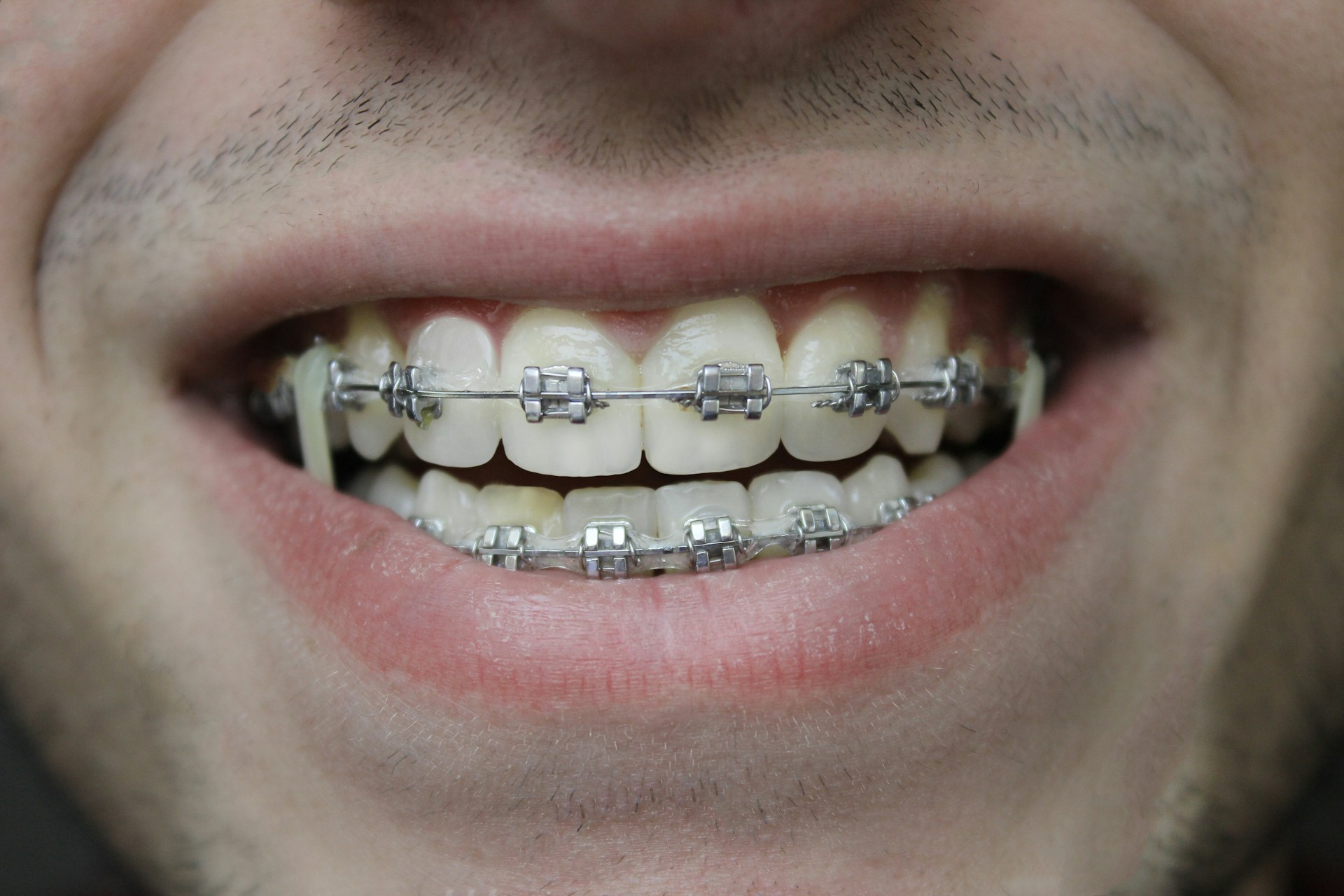 Close-up of a person's mouth photo (2)