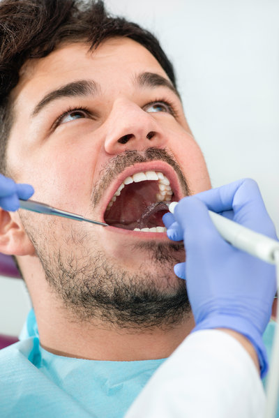 Dental plaque removal at dentist