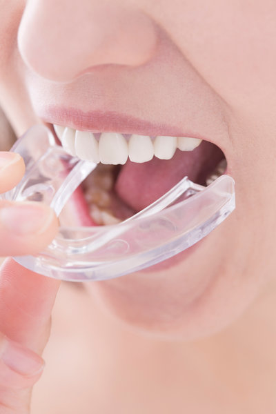 close up young asian beautiful woman smiling with hand holding dental aligner retainer (invisible) at dental clinic for beautiful teeth treatment course concept
